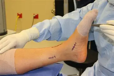 Pain Management